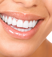Teeth Whitening Services Newport News, VA